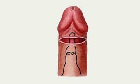 žaluď penisu